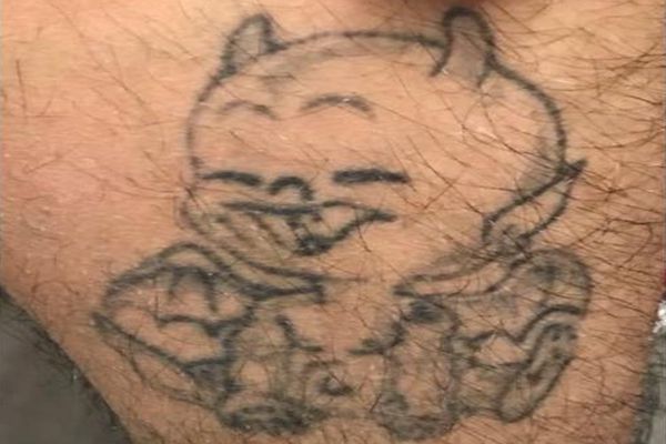 Been tattoo voor de eerste laser behandeling