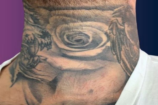 Grote nek tattoo voor de eerste laser behandeling