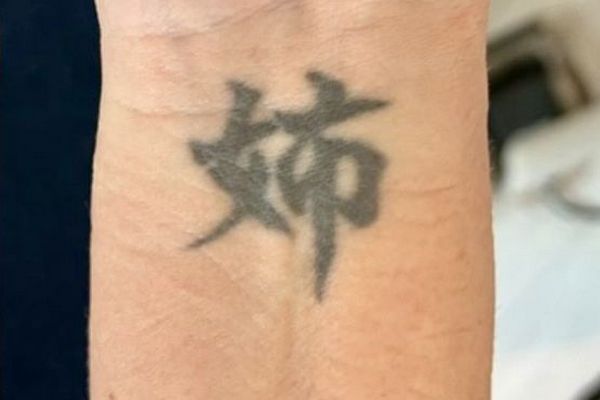 Pols tattoo voor de eerste laser behandeling